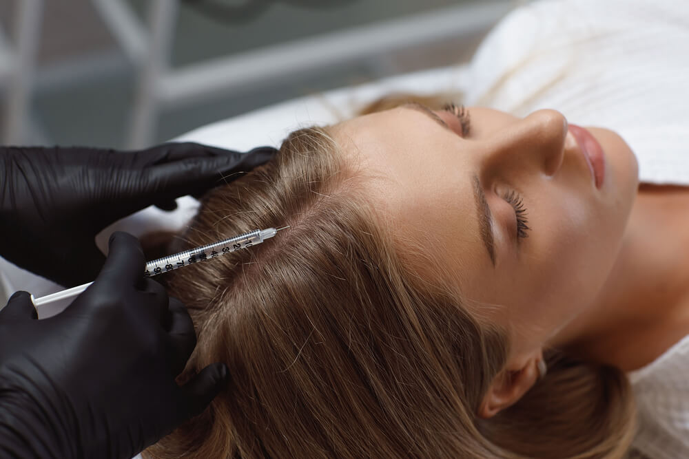 Unlocking Confidence: Mesotherapy's Role In Hair Loss Treatment